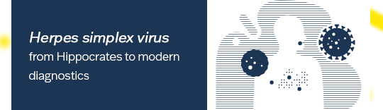 Herpes simplex virus – from Hippocrates to modern diagnostics